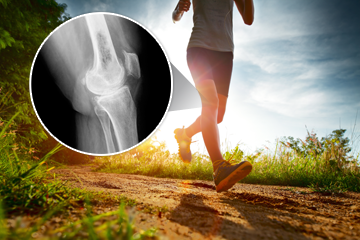Osteoporosis joints bones maintenance